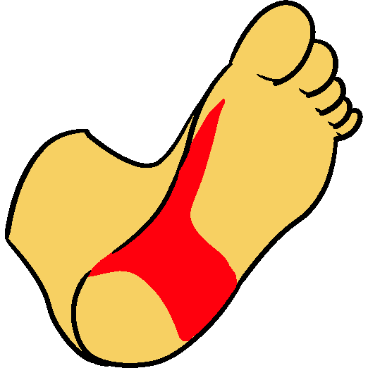 A yellow foot from below with bright red above the heel, and travelling up the arch.
